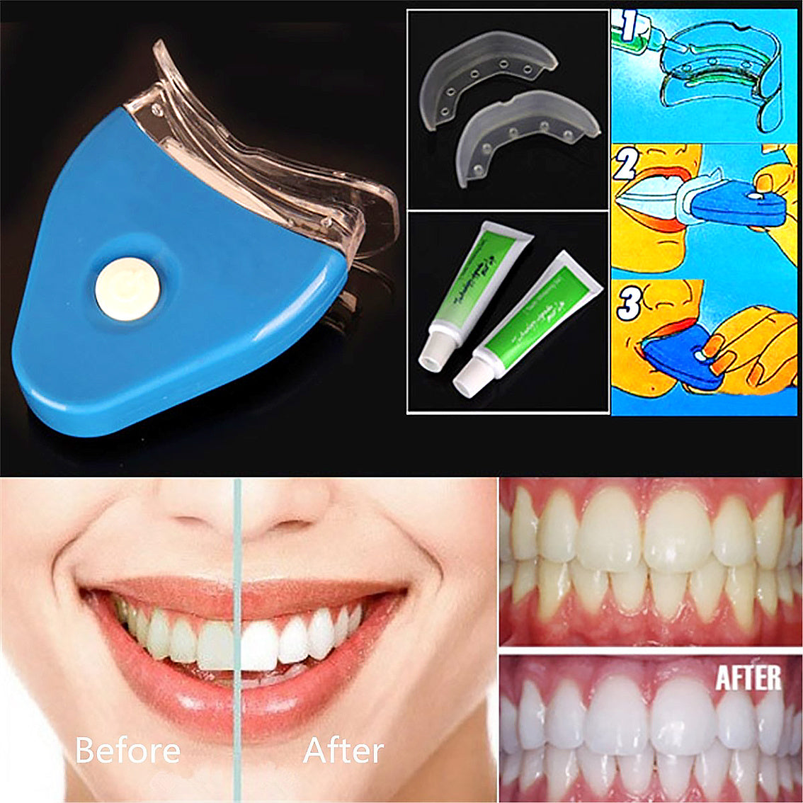 Oral Gel Teeth Whitening