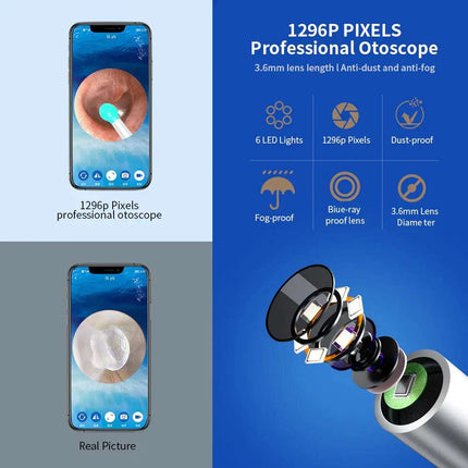 NE3 Ear Cleaner Otoscope Ear Wax Removal Tool With Camera LED Light Wireless Ear Endoscope Ear Cleaning Kit For I-phone Fendax 0